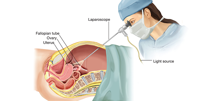 laparoscopic surgeon in nagpur